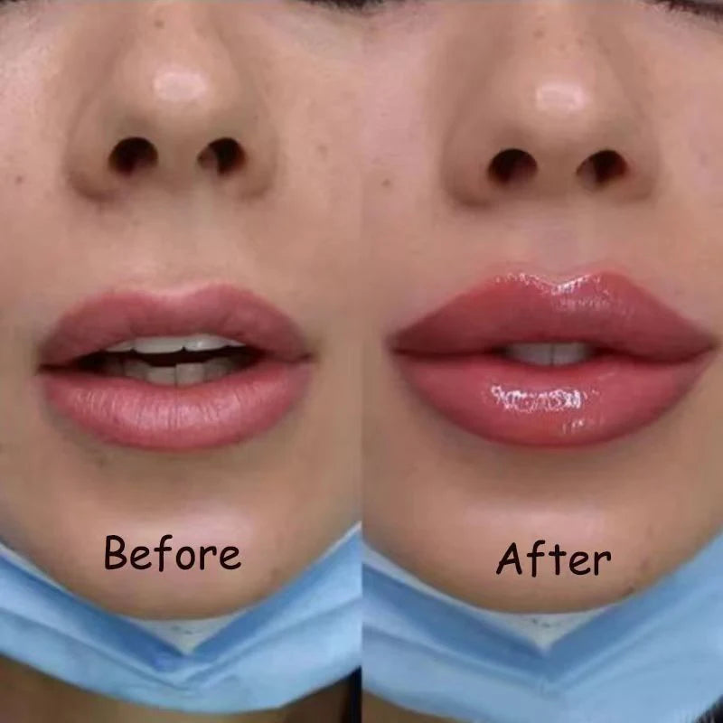 Lip Plumping Serum - Volumizing & Anti-Aging